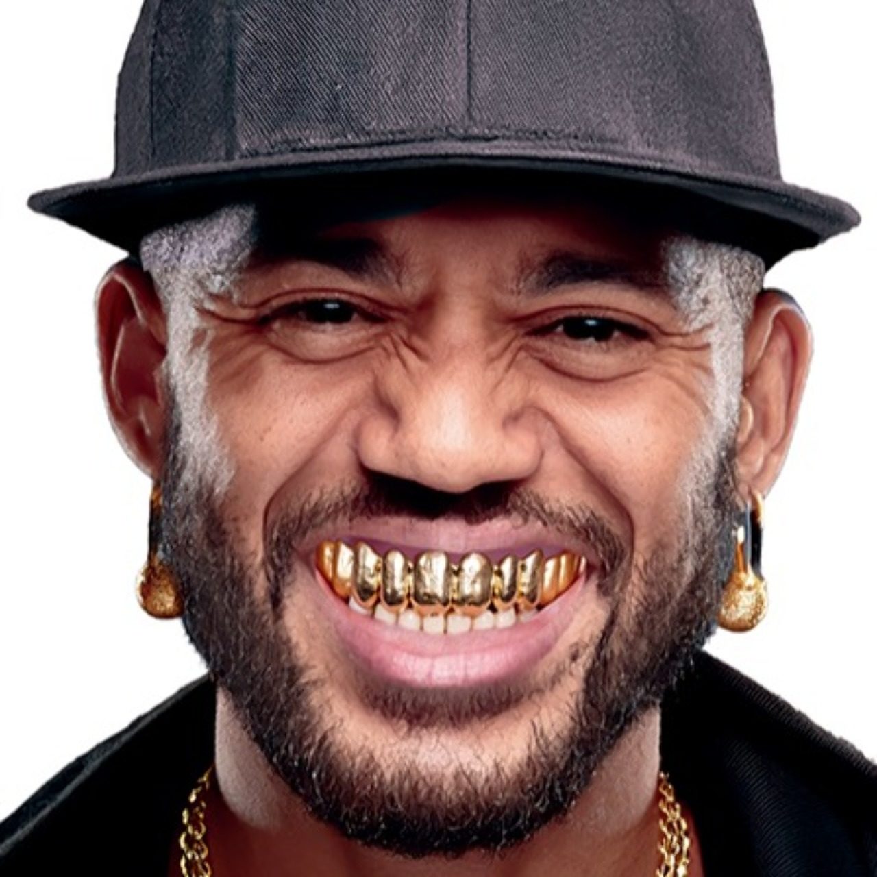 Dentition Dorée