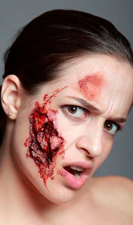 Blessure Morsure Latex