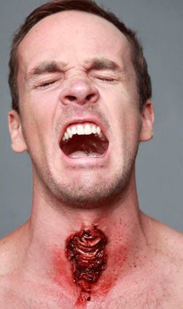 Blessure Trachée Latex